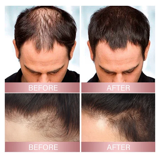 hair growth spray - Image 3