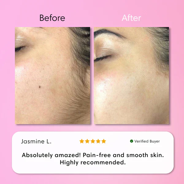 Hair Removal Kit - Image 4