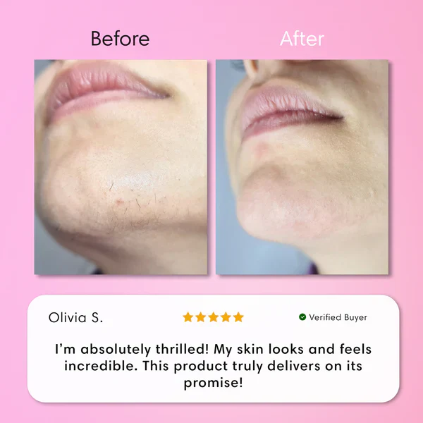 Hair Removal Kit - Image 8