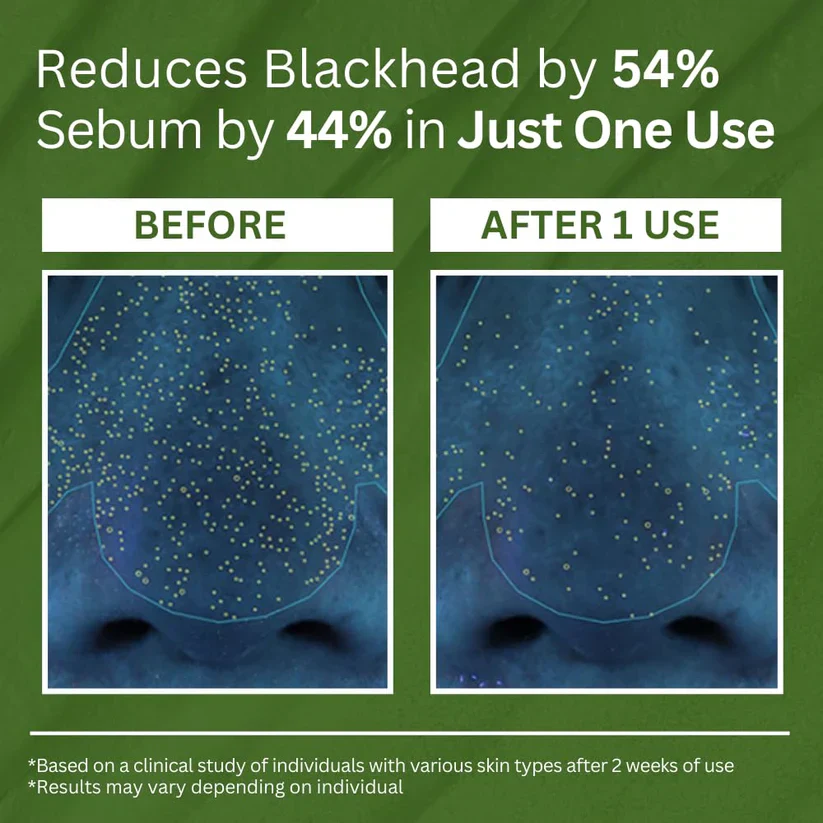Smooth, Radiant Skin – Activated by Holy Basil & Bubble Detox Action - Image 11