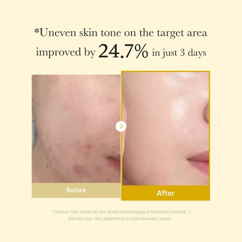 Kojic Acid Turmeric Night Wrapping Mask - Image 4