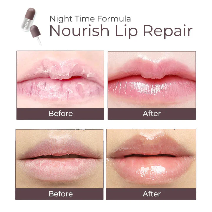Lip Plumper Kit - Image 9