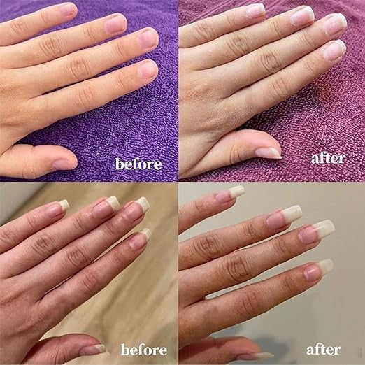 Nail Growth AndStrengthening Serum - Image 4