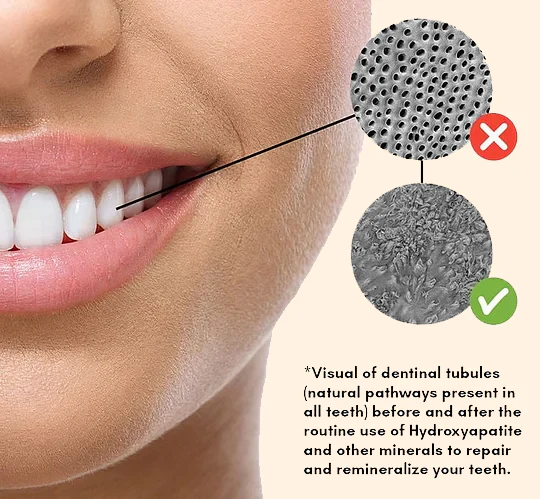 Remineralizing Gum - Image 5