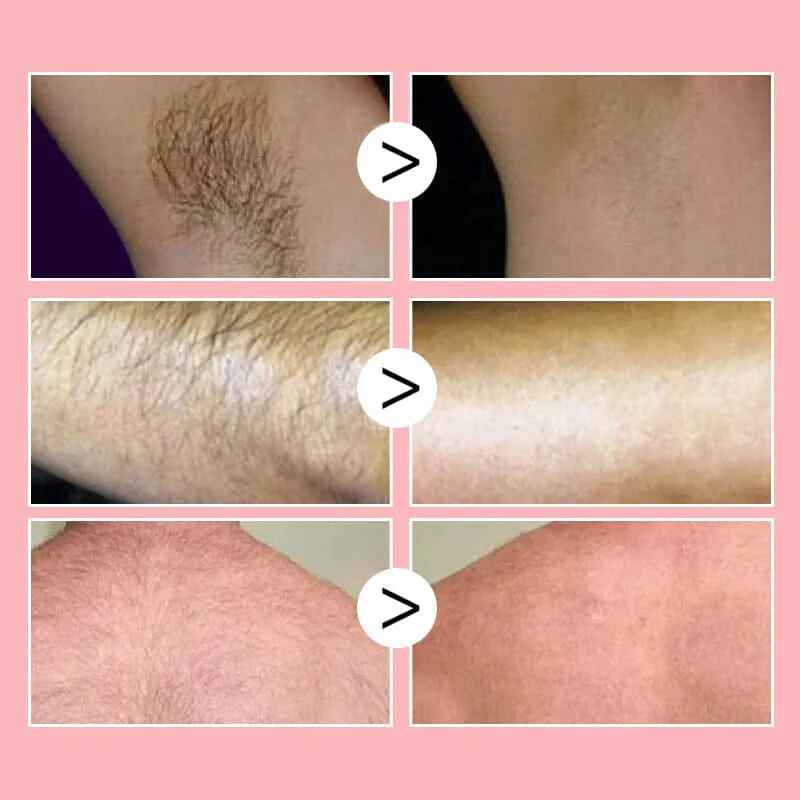 Smooth as Honey: Mousse Hair Removal Spray - Image 3