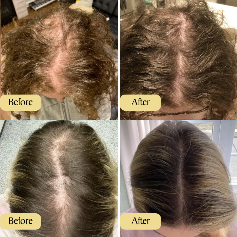 Spring Sale 49% OFF！ Natural Hair Growth Oil - Image 8