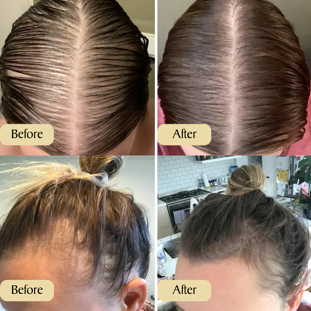 Spring Sale 49% OFF！ Natural Hair Growth Oil - Image 9