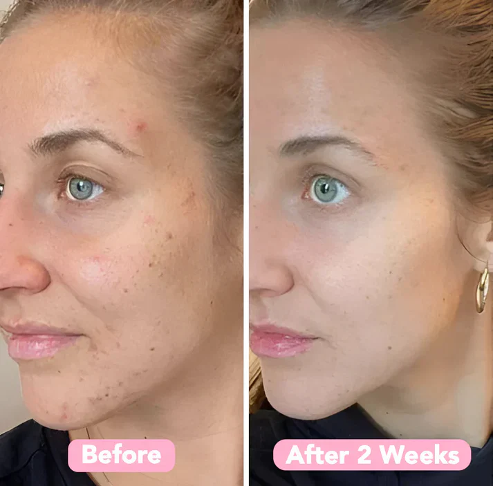 Turmeric Kojic Acid Cleansing Pads - Image 10