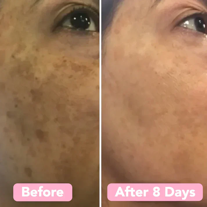 Turmeric Kojic Acid Cleansing Pads - Image 7