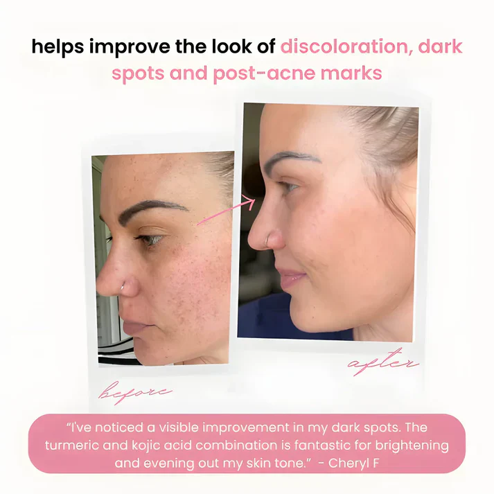 Turmeric Kojic Acid Cleansing Pads - Image 8