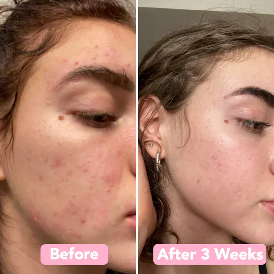Turmeric Kojic Acid Cleansing Pads - Image 9